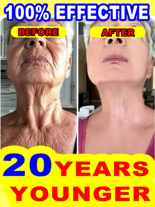 Wrinkles disappear,20 years younger