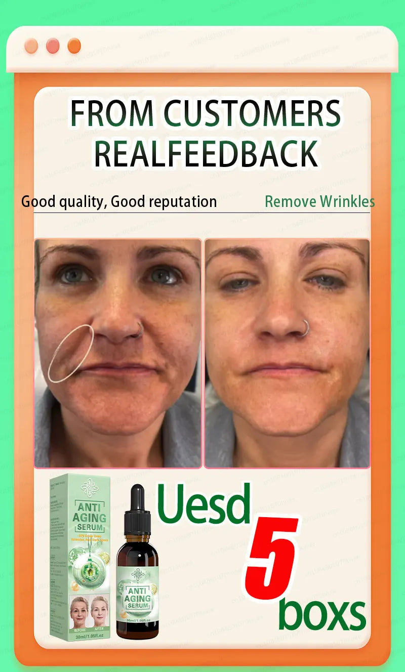 wrinkles disappeared