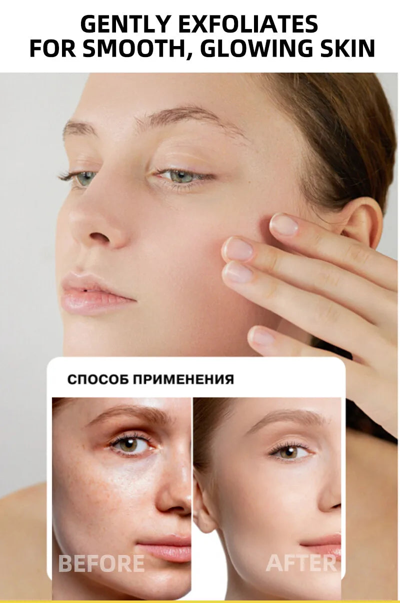 Lemon VC Facial Serum Brightens Skin Tone Fades Acne Marks Evens Complexion 50x Vitamin C Whitening Essence for Radiant Glow