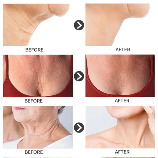 10PCS Collagen Anti Wrinkle Neck Mask Anti Aging Fade Fine Lines Firm Skin Moisturizing Brighten Rejuvenating SkinCare Cosmetics