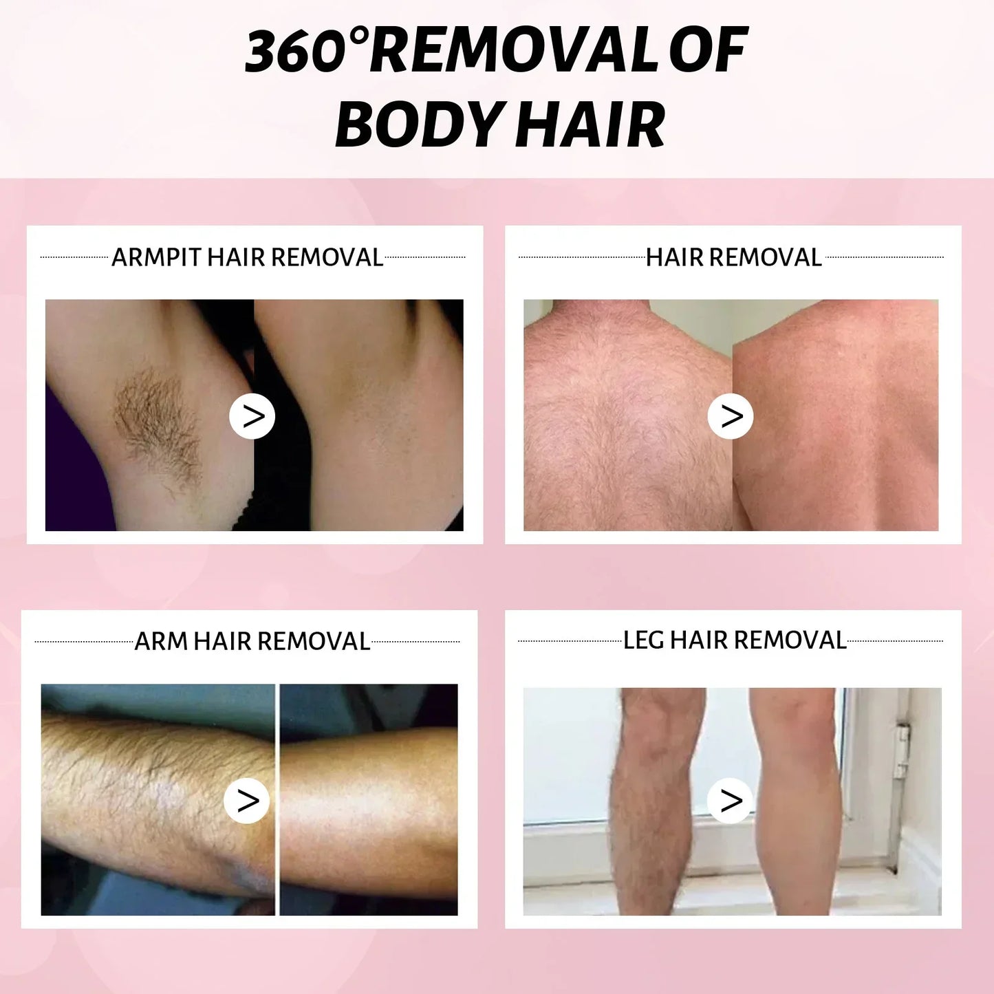 2 Minutes Fast Hair Removal Spray Painless Hair Growth Inhibitor Arm Armpit Leg Permanent Depilatory for Men Women Repair Care