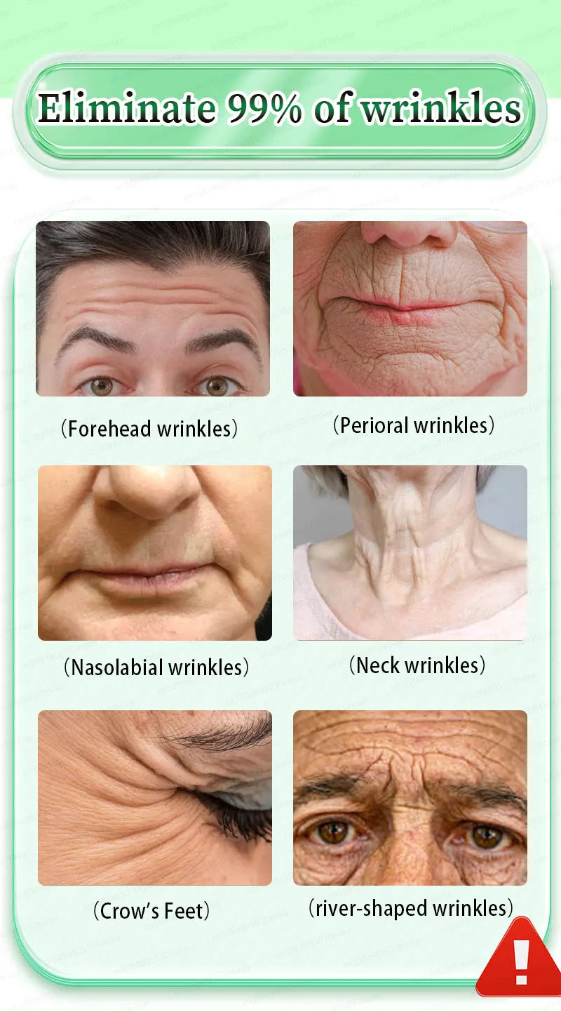 wrinkles disappeared
