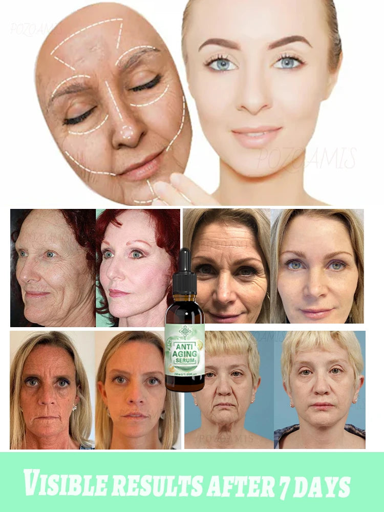 wrinkles disappeared