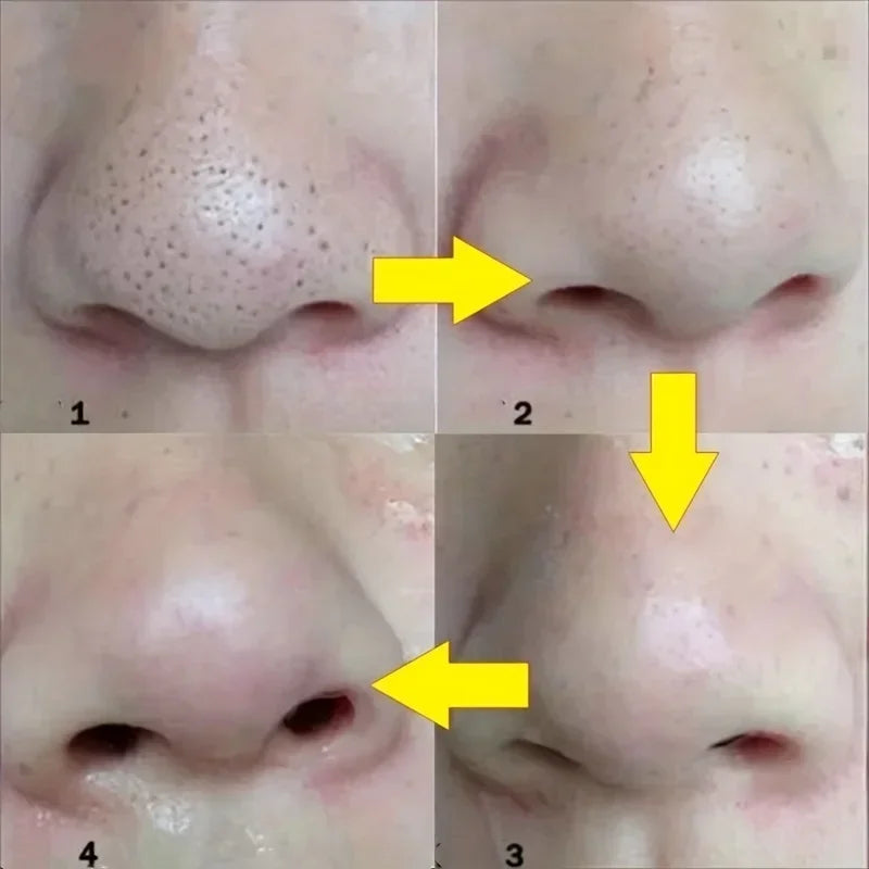 15pcs Blackhead Nose Strips Deep Cleansing Nasal Spot Facial Dot Stickers Nose Mask Shill For Acne & Black Head - Dropship