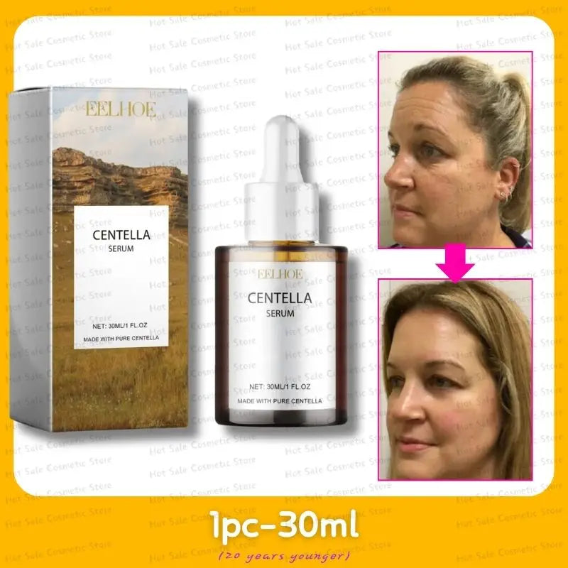 Korean Centella Asiatica Face Serum Nourish Dry Skin Smoothing Rejuvenation Skin Brightening Whitening Cream Facial Moisturizer 1pc