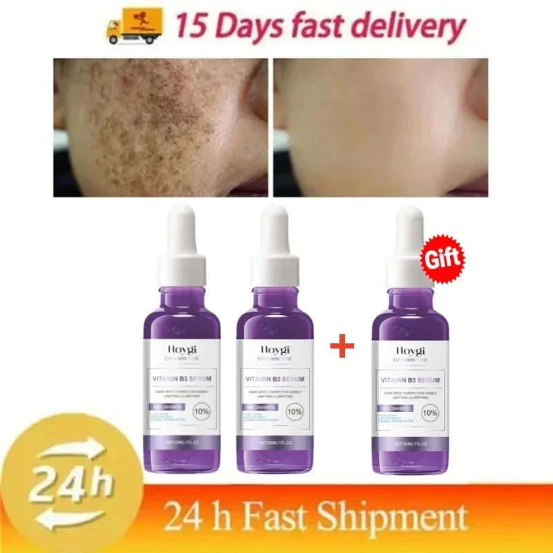 Dark Spots Remover Whitening Serum Face Freckle Melanin Correcting Anti Pigmentation Brighten Beauty Korean Day Night Skin Care Buy 2 get 1 free