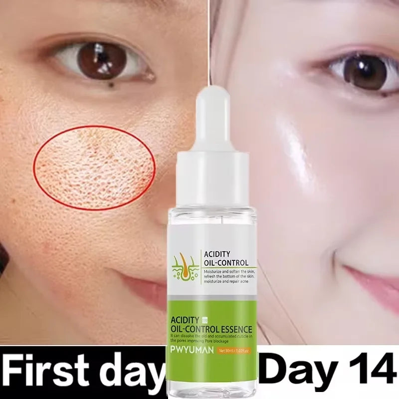 Acidity Pore Shrink Face Serum Remove Blackheads Acne Oil Control Repair Essence Moisturizing Nourish Pores Firming Facial Care 1pc-30g
