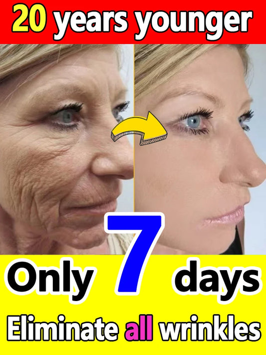 wrinkles disappeared