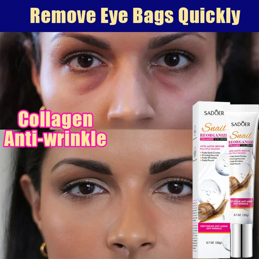 Remove Eyes Bags Eye CreamSnail Collagen Anti Dark Circles Anti-wrinkleMoisturizing Firming Beauty Eyes SkinCare Products
