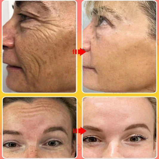 Sakura Whitening Face Serum Anti Aging Fade Fine Lines Tighten Pores Improve Melanin Pigment Dull Moisturizer Brighten Skin Care