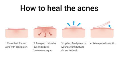 BREYLEE Facial Cleanser Toner Essence Face Cream Gel Facial Mask Set