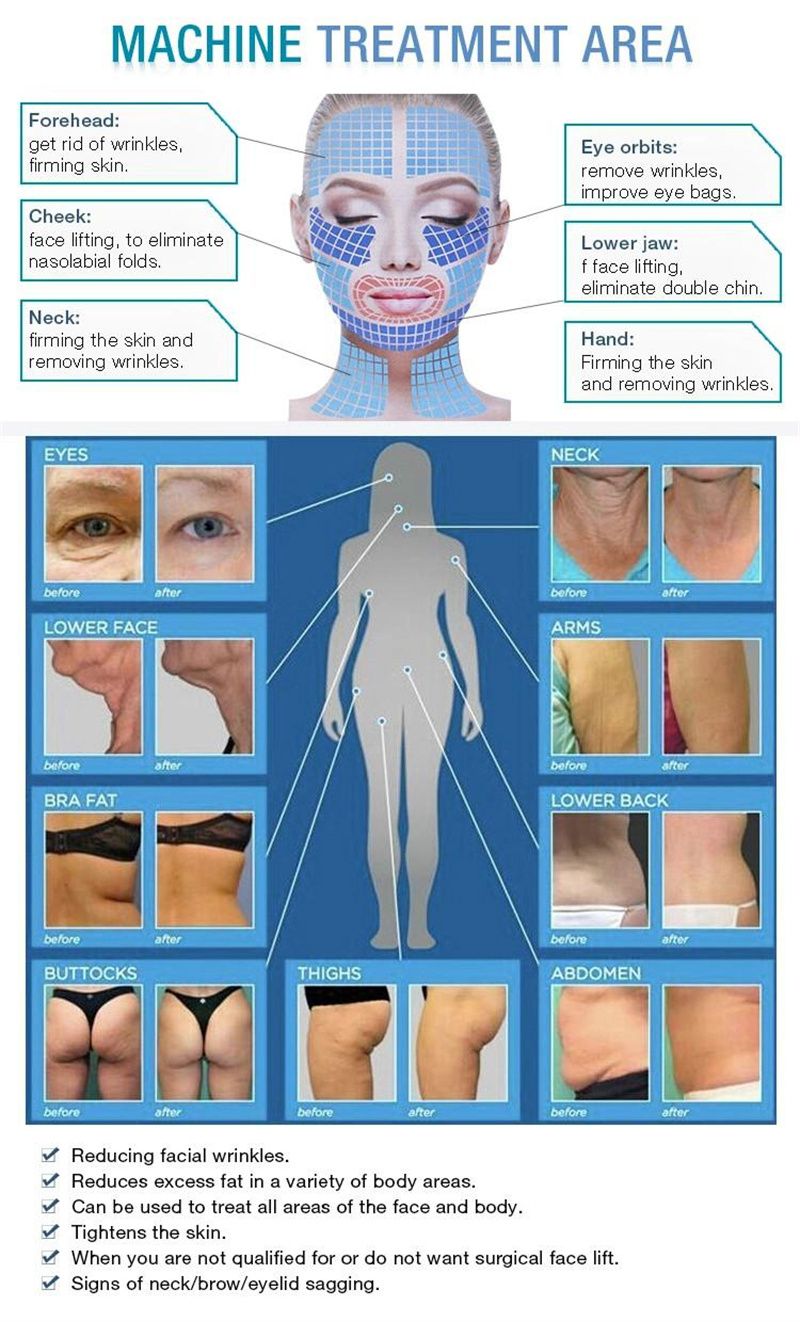 NEO Equipment Slimming Ultrasound Cellulite Wrinkle Removal Face Lift 2 Handles Ultra 360 Fat Reducing Machine For Salon