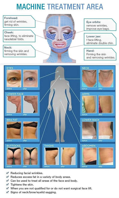 NEO Equipment Slimming Ultrasound Cellulite Wrinkle Removal Face Lift 2 Handles Ultra 360 Fat Reducing Machine For Salon