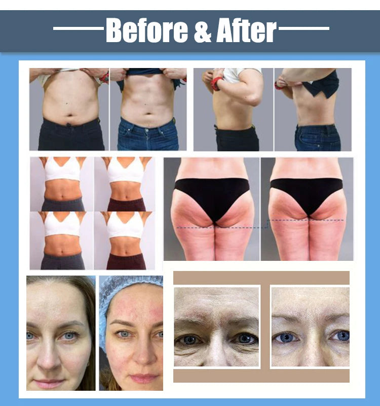 Ultra 360 Fat Reducing Machine Portable NEO Equipment Slimming Machine Ultrasonic Cellulite Wrinkle Removal Face Lift 2 Handles