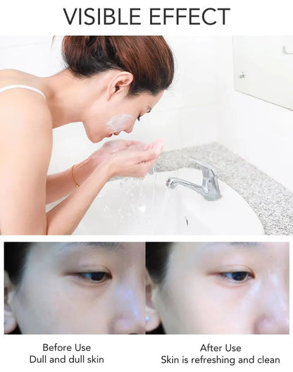 AILKE Whitening Dark Spot Remove Facial Skin Care Cream With Collagen Anti- Freckles Wrinkle Repair Women Premium Face Product