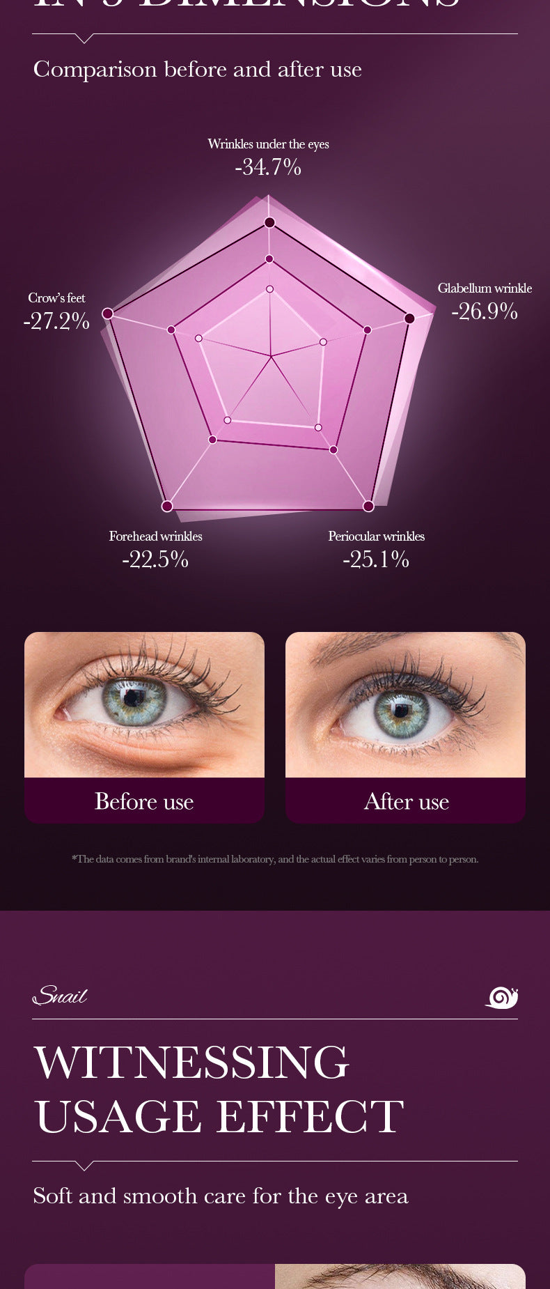 Remove Eyes Bags Eye CreamSnail Collagen Anti Dark Circles Anti-wrinkleMoisturizing Firming Beauty Eyes SkinCare Products