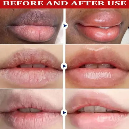 Exfoliating Lip Treatment Mask Gloss - Lightening Melanin Dark Lip Balm Remove Pink Moisturizing Reduce Lip Lines Improve Drynes