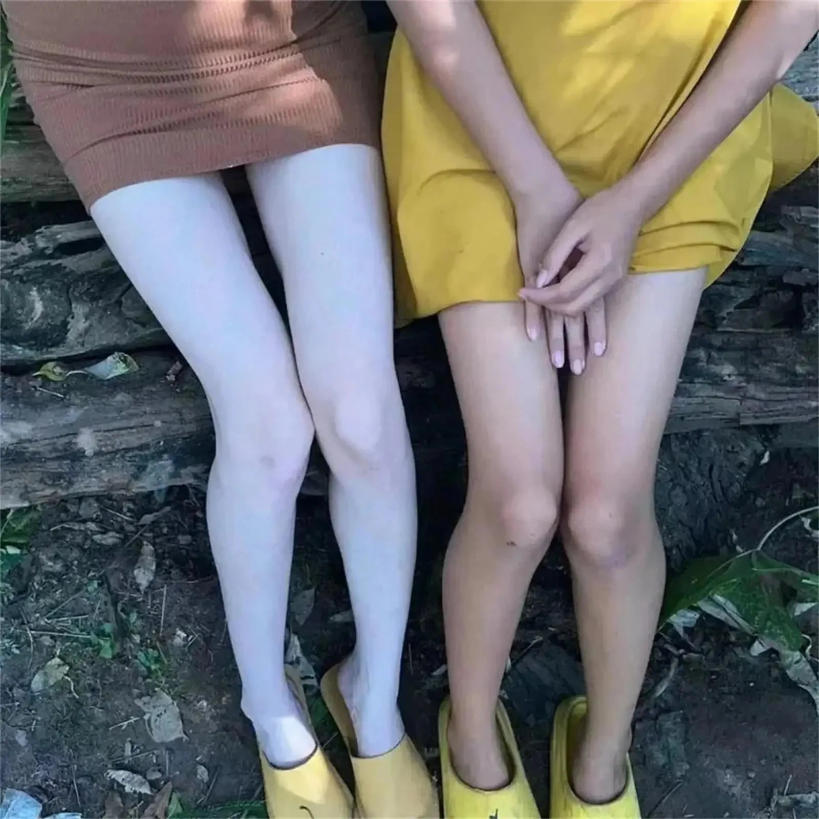 Nicotinamide Brightening Cream For Dark Skin Effective Lighten Thigh Inner Bleach Remove Melanin Private Parts Brighten Cream