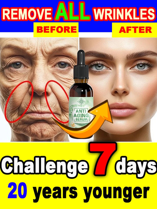 wrinkles disappeared