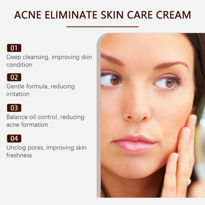 Pimple Acne Treatment Face Cream Nourish Balance Oil Control Refreshing Repairing Pimple Remover Acne Removing Cleansing Cream