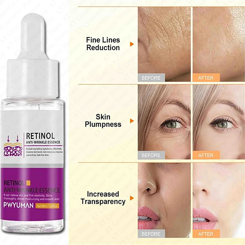 Retinol Against Wrinkles Serum Remove Wrinkle Firming Fade Fine Lines Anti Aging Improve Laugh Line Moisturizing Skin Care Korea