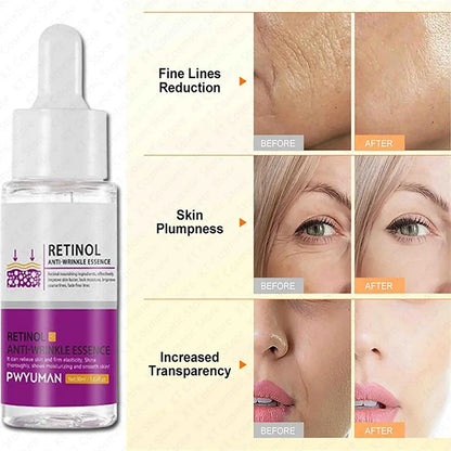 Retinol Against Wrinkles Serum Remove Wrinkle Firming Fade Fine Lines Anti Aging Improve Laugh Line Moisturizing Skin Care Korea