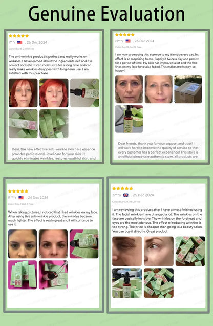 wrinkles disappear become beautiful now