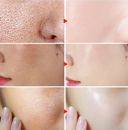 Acidity Pore Shrink Face Serum Remove Blackheads Acne Oil Control Repair Essence Moisturizing Nourish Pores Firming Facial Care
