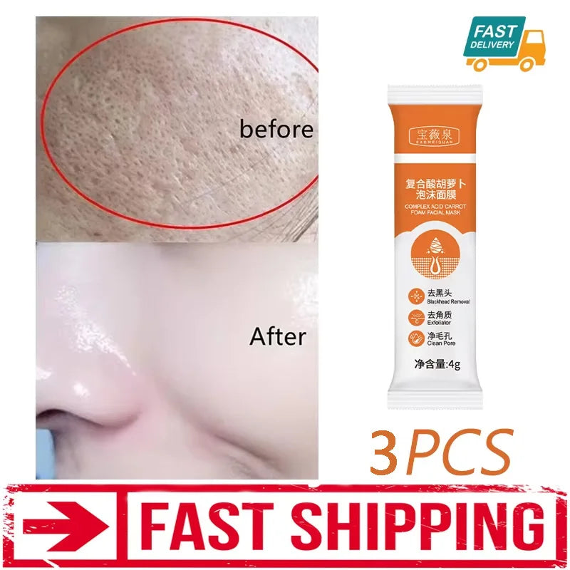 Acidity Pore Shrink Face Serum Remove Blackheads Acne Oil Control Repair Essence Moisturizing Nourish Pores Firming Facial Care 3pc-12g