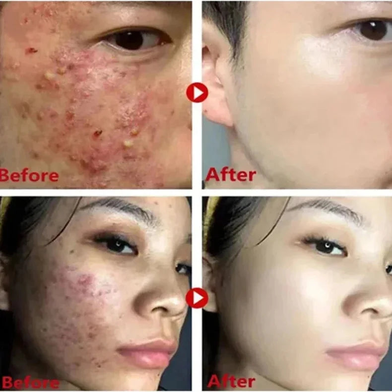 Alaska Volcano Mask Mugwort Cleansing Mask Stick Shrink Pores Acne Deep Blackhead Remover Facial Cleansing Moisturizing Mask 40g