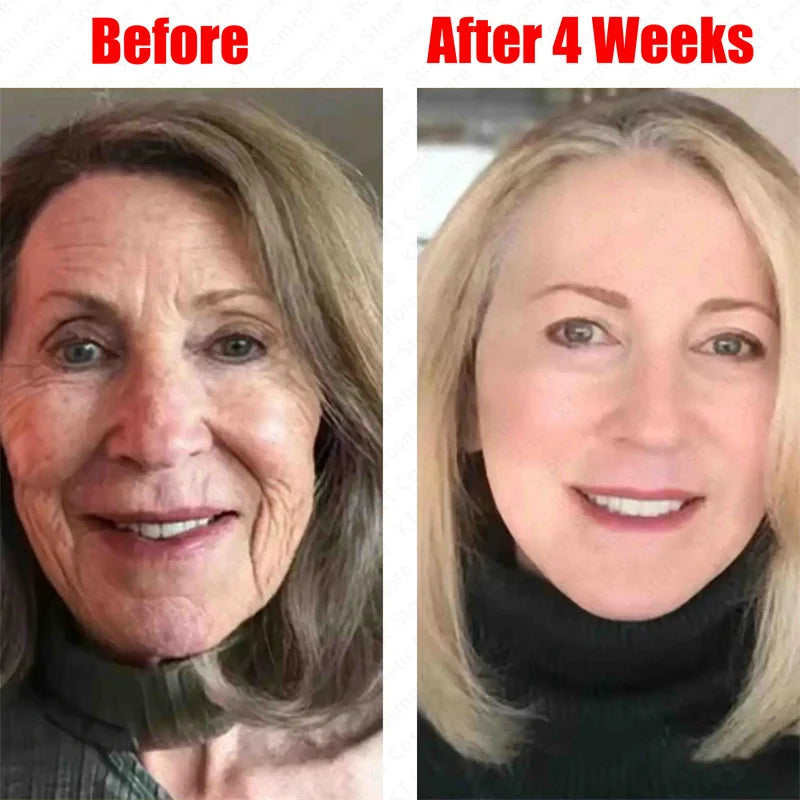 Retinol Against Wrinkles Serum Remove Wrinkle Firming Fade Fine Lines Anti Aging Improve Laugh Line Moisturizing Skin Care Korea