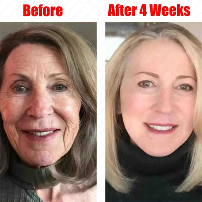 Retinol Against Wrinkles Serum Remove Wrinkle Firming Fade Fine Lines Anti Aging Improve Laugh Line Moisturizing Skin Care Korea