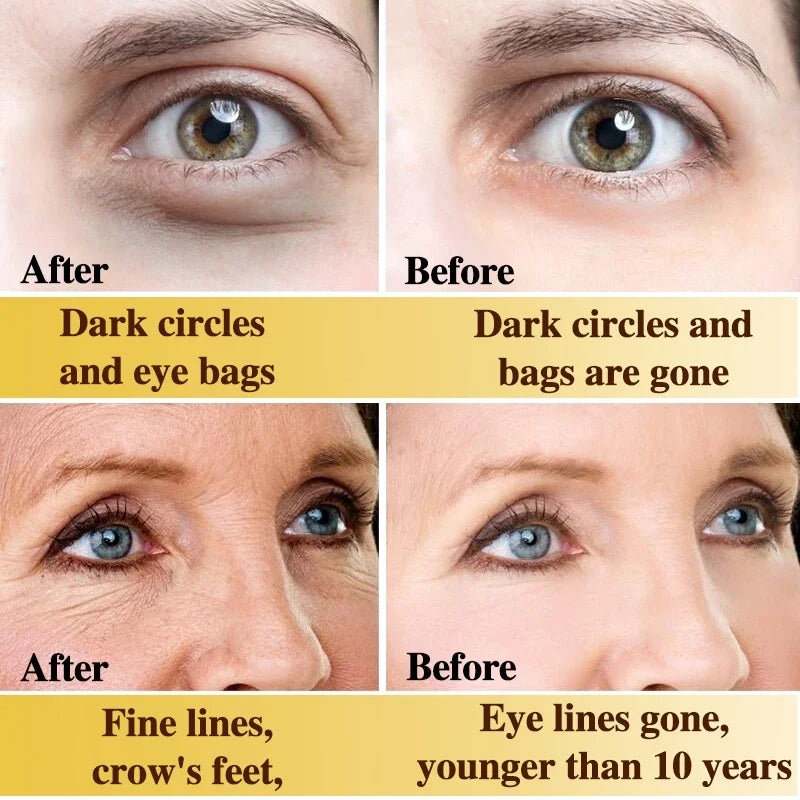 Remove Eyes Bags Eye CreamSnail Collagen Anti Dark Circles Anti-wrinkleMoisturizing Firming Beauty Eyes SkinCare Products