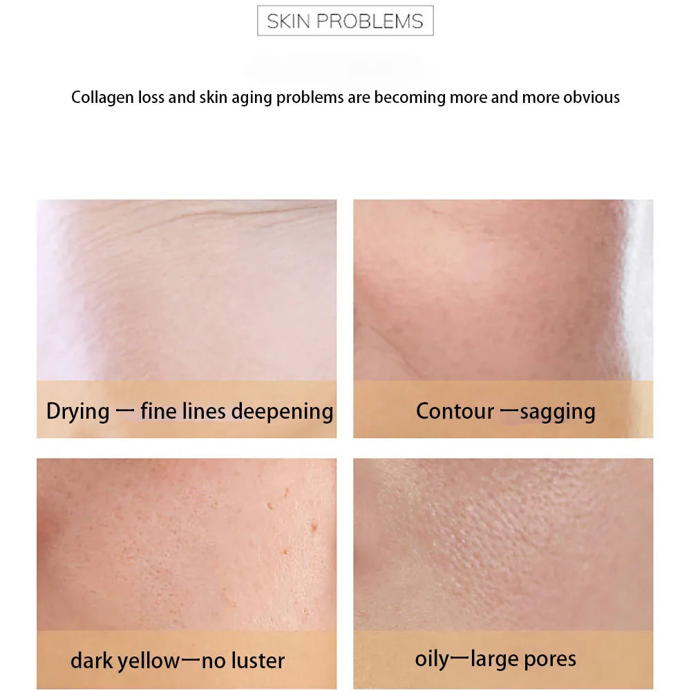 Pro-xylane Remove Wrinkles Face Cream Korean Moisturizing Fades Fine Lines Lifting Firming Brighten Skin Looks Visibly Younger