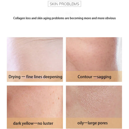 Pro-xylane Remove Wrinkles Face Cream Korean Moisturizing Fades Fine Lines Lifting Firming Brighten Skin Looks Visibly Younger