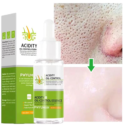Salicylic Acid Pore Shrinking Cream Eliminate Large Pores Serum Remove Blackhead Acne Repairing Tightening Skin Care Cosmetics 30g Serum