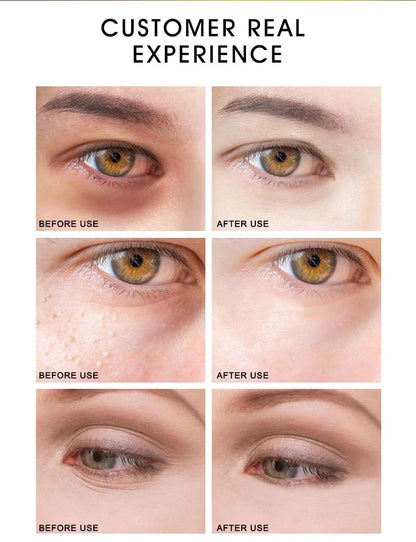 ARTISCARE 24K Gold SkinCare SET Face Cream Moisturizing Serum Dark Circles Essence Korean Skin Care Products