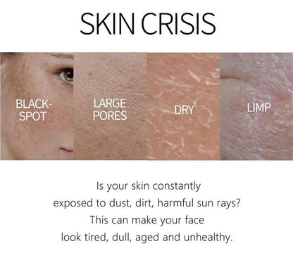 Whitening Freckle Cream Melasma Dark Spots Pigmentation Removal Product Fade Stain Melanin Fast Repair Brighten Korean Skin Care