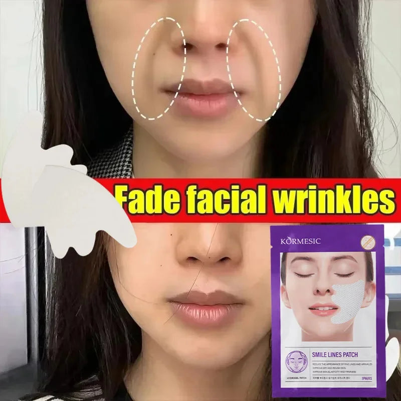 Hydrogel Smile Lines Patch Reduce Fne Lines Lifting Sagging Improve Dry Rough Smooth Enhance Skin Elasticity Moisturizing Care 1 pc