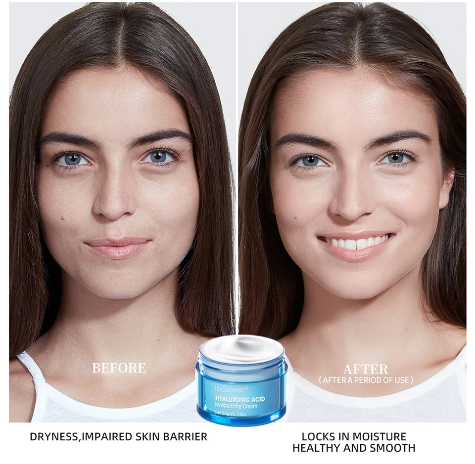 Hydro Boost Face Moisturizer with Hyaluronic Acid for Dry Skin, Oil-Free and Non-Comedogenic Water Gel Face Lotion