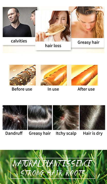 Rosemary shampoo soap without silicone oil plant shampoo soap cleanses the scalp nourishes hair controls oil