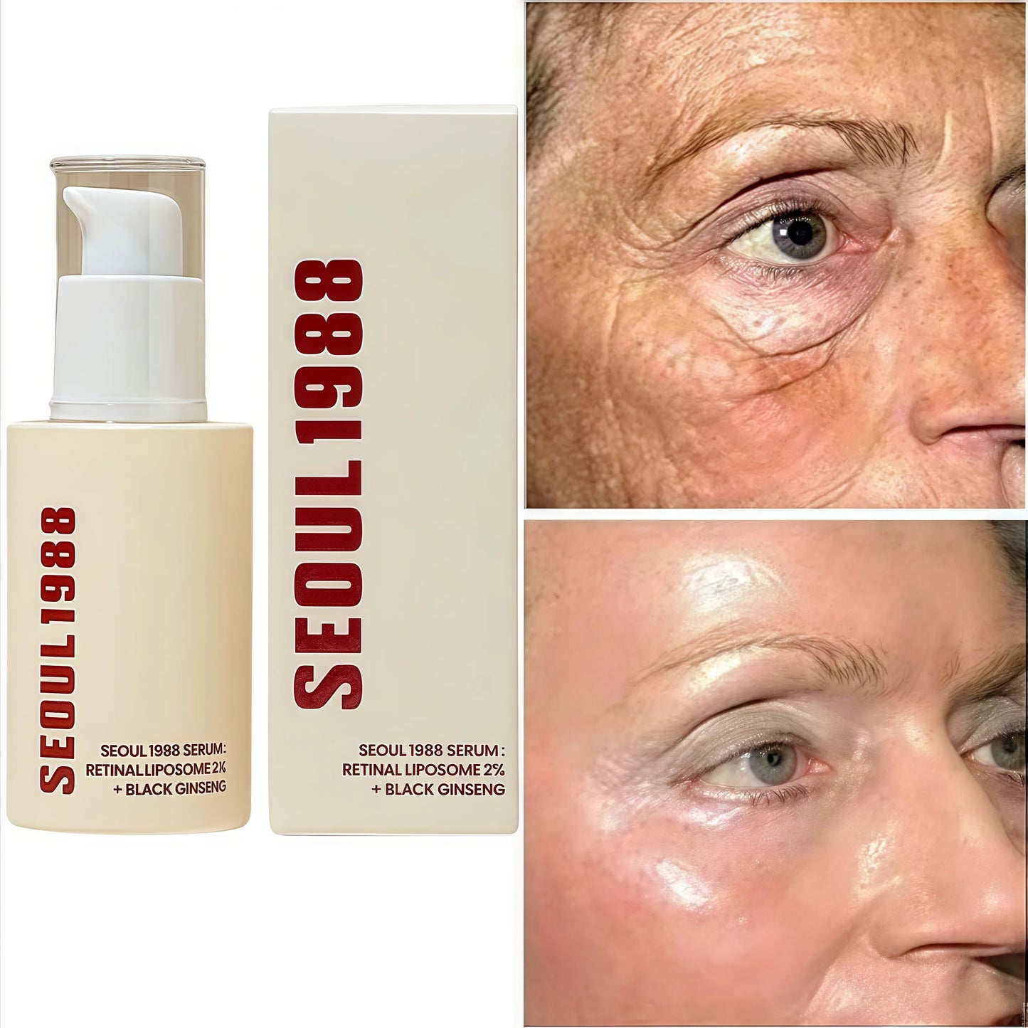 SEOUL 1988 Eye Cream Niacinamide 2% Retinal Acid Ginseng Serum Lighten Fine Lines Firming Pores Brightening Face Korean Skincare 1pc- Serum