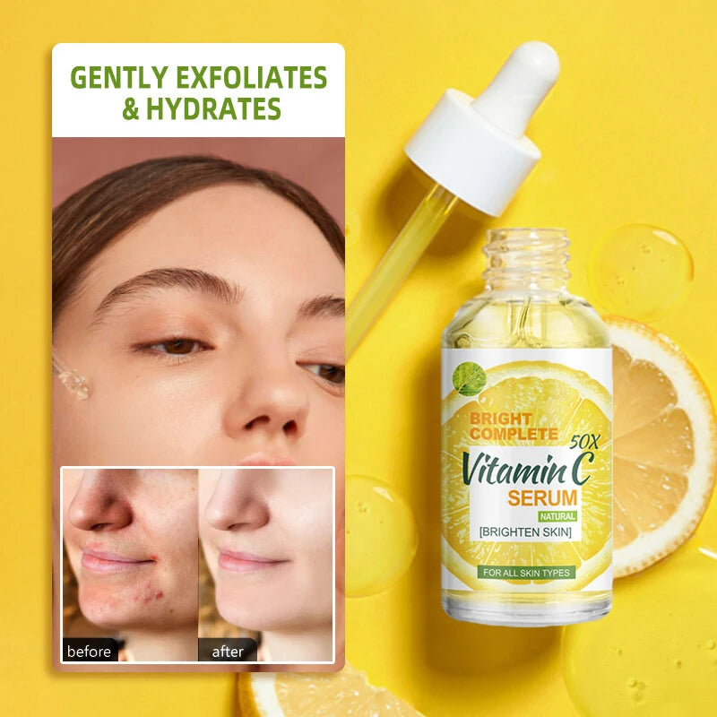 Lemon VC Facial Serum Brightens Skin Tone Fades Acne Marks Evens Complexion 50x Vitamin C Whitening Essence for Radiant Glow