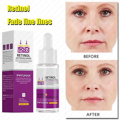 Retinol Against Wrinkles Serum Remove Wrinkle Firming Fade Fine Lines Anti Aging Improve Laugh Line Moisturizing Skin Care Korea