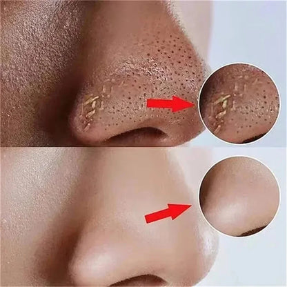 Salicylic Acid Pore Shrinking Cream Reduce Large Pore Tighten Refining Face Repair Rough Dull Pore Brighten Moisturize Skin Care