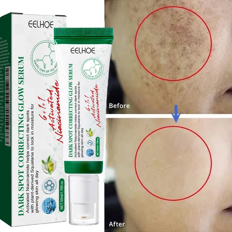 Nicotinamide Whitening Freckles Face Cream Remove Melasma Dark Spots Corrector Fade Melanin Acne Anti-Aging Brighten Skin Care 50g