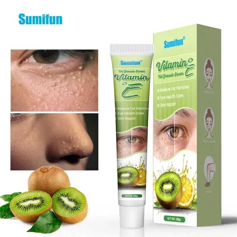 Fat Granules Remover Eye Cream Skin Care Products