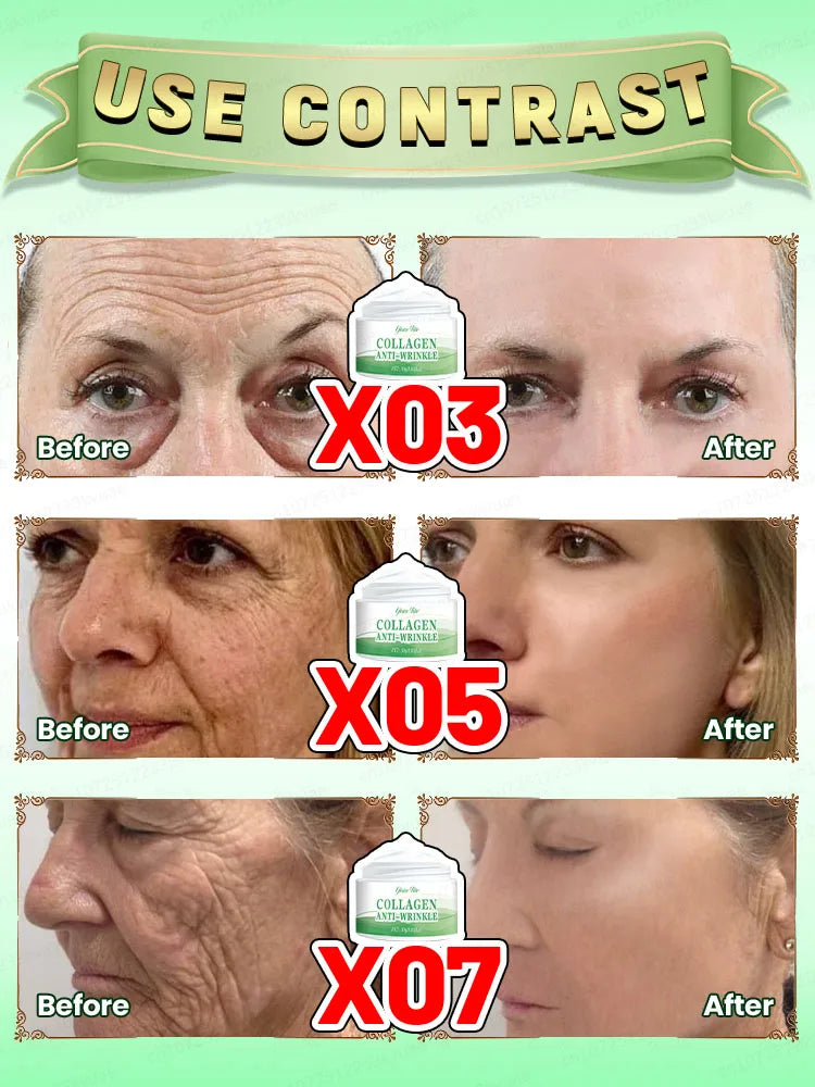 Wrinkles disappear in just 7 days