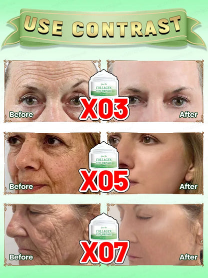 Wrinkles disappear in just 7 days