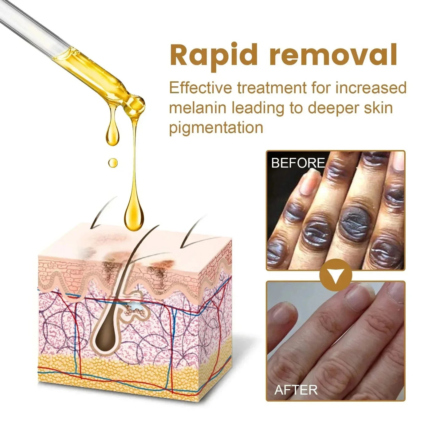 Dark Knuckles Fast Brighten Serum Elbows Hands Knee Armpits Brightening Serum Clarify Black Skin Lighten Stains Remover Essence